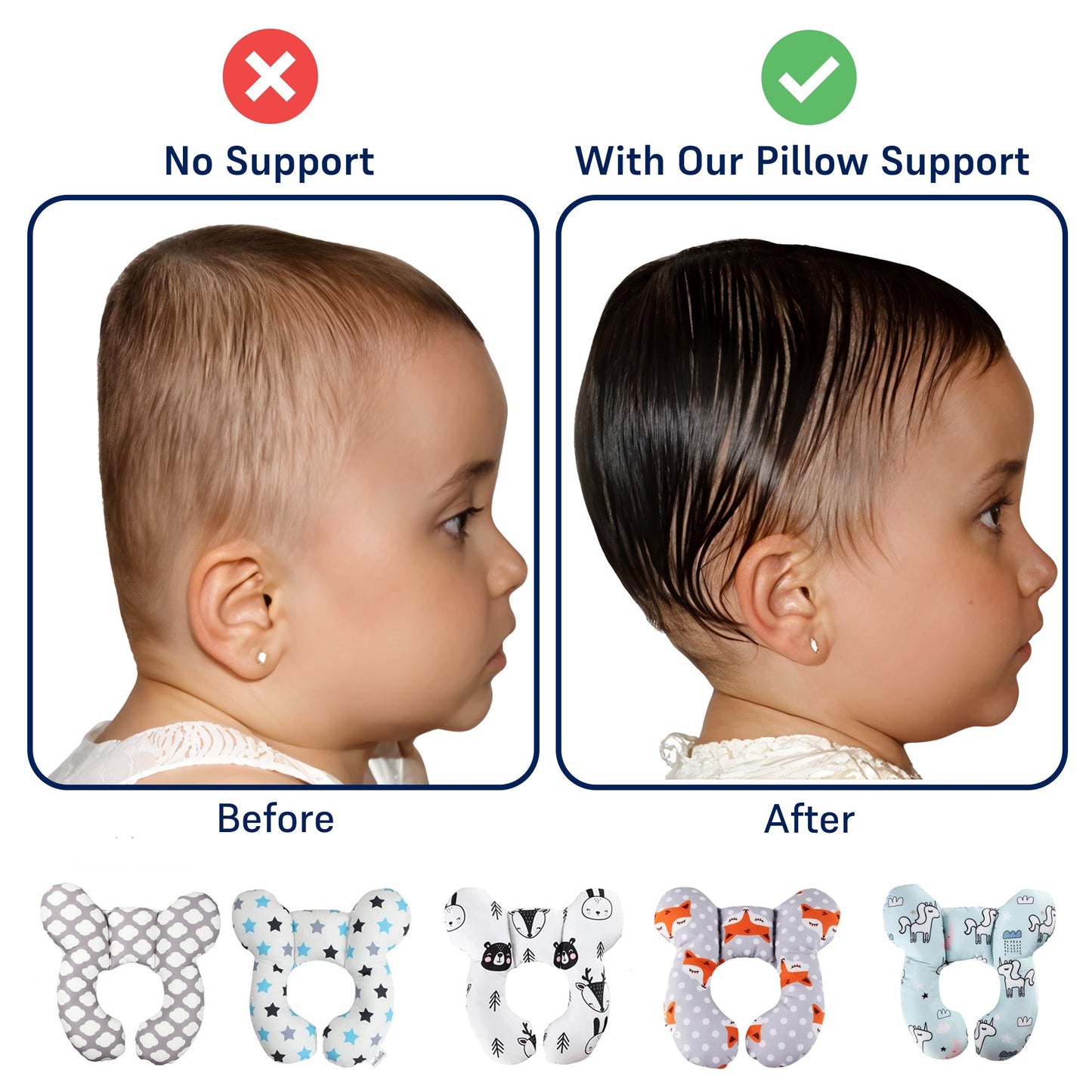 Unisex Baby Support Pillow for Head & Neck Alignment - Cotton, 0-15 Months, Multiple Styles