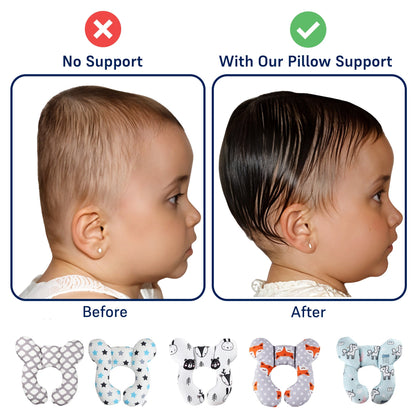 Unisex Baby Support Pillow for Head & Neck Alignment - Cotton, 0-15 Months, Multiple Styles